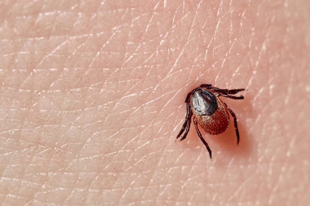 Pests In Music: From Lyrics To Real-Life Infestations Pests In Music: From Lyrics To Real-Life Infestations